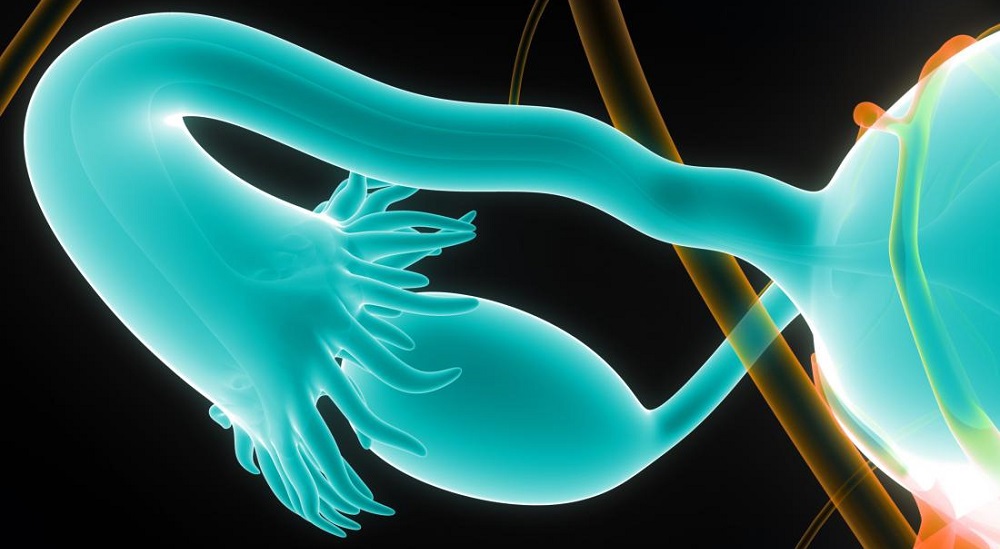 when fallopian tubes are blocked the best solution is undergoing IVF when fallopian tubes are blocked the best solution is undergoing IVF