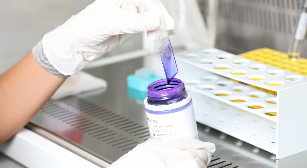 Azoury IVF Lebanon Clinic andrologist performing a semen analysis Azoury IVF Lebanon Clinic andrologist performing a semen analysis