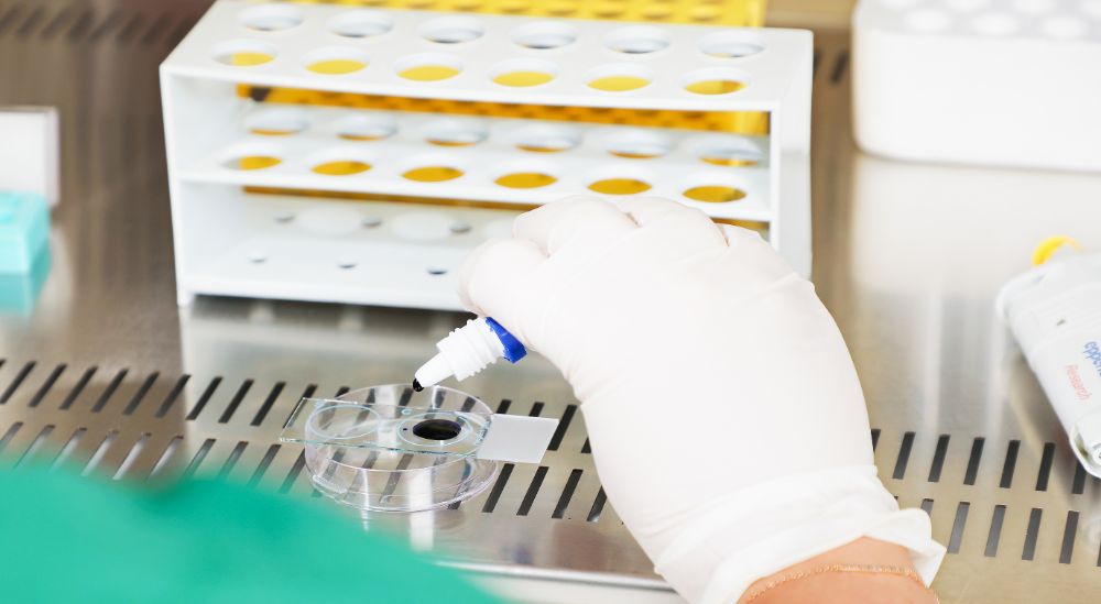 Azoury IVF Lebanon Clinic andrologist performing a sperm DNA fragmentation test Azoury IVF Lebanon Clinic andrologist performing a sperm DNA fragmentation test