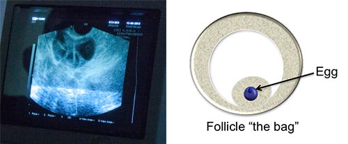 The-follicles-are-not-the-oocytes