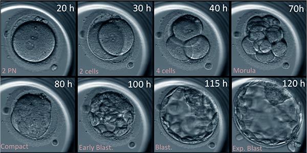 Transfer-embryos